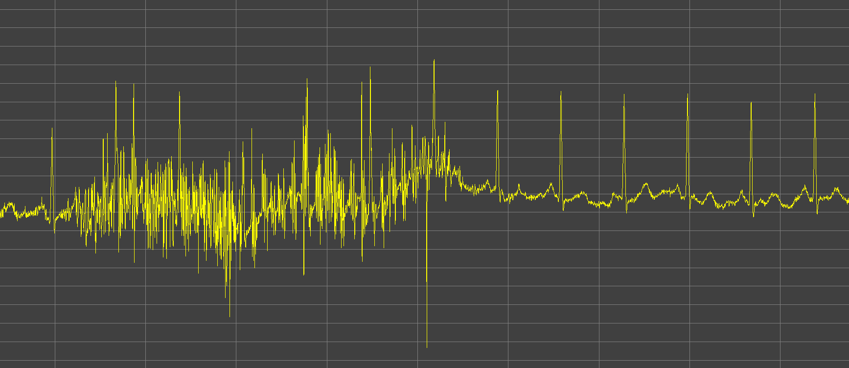 ECG high noise