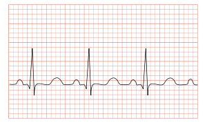 ECG standard