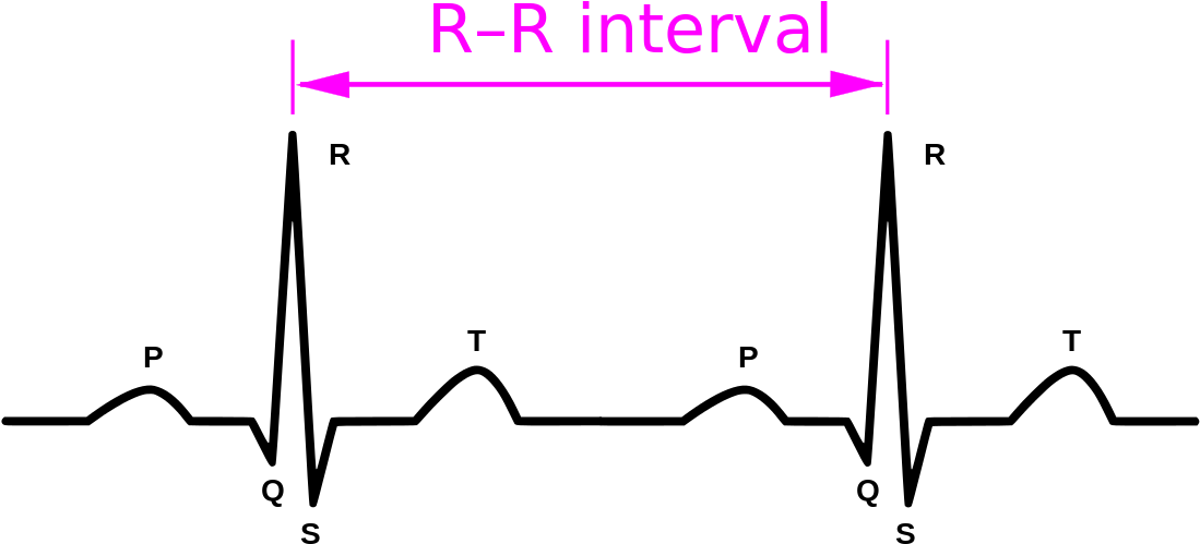 R-R intervalles