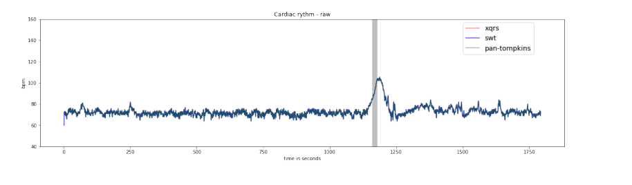 Cardiac rhythm